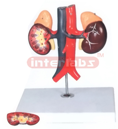 HUMAN KIDNEY WITH VESSEL